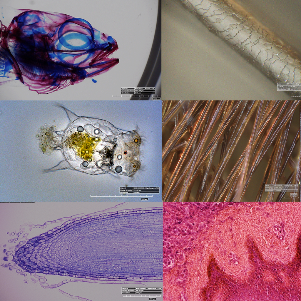 3D Digital Microscope : Biological - For measuring and analysis